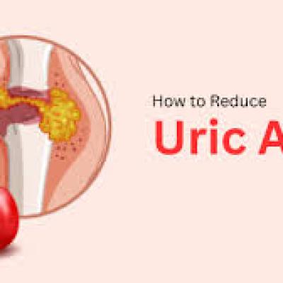 Top 5  Drinks to Lower Uric Acid Levels
