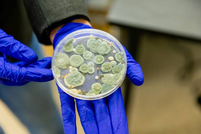 Microbiological Consultation